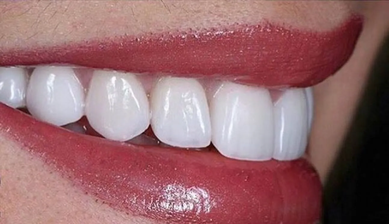 dental treatment 1