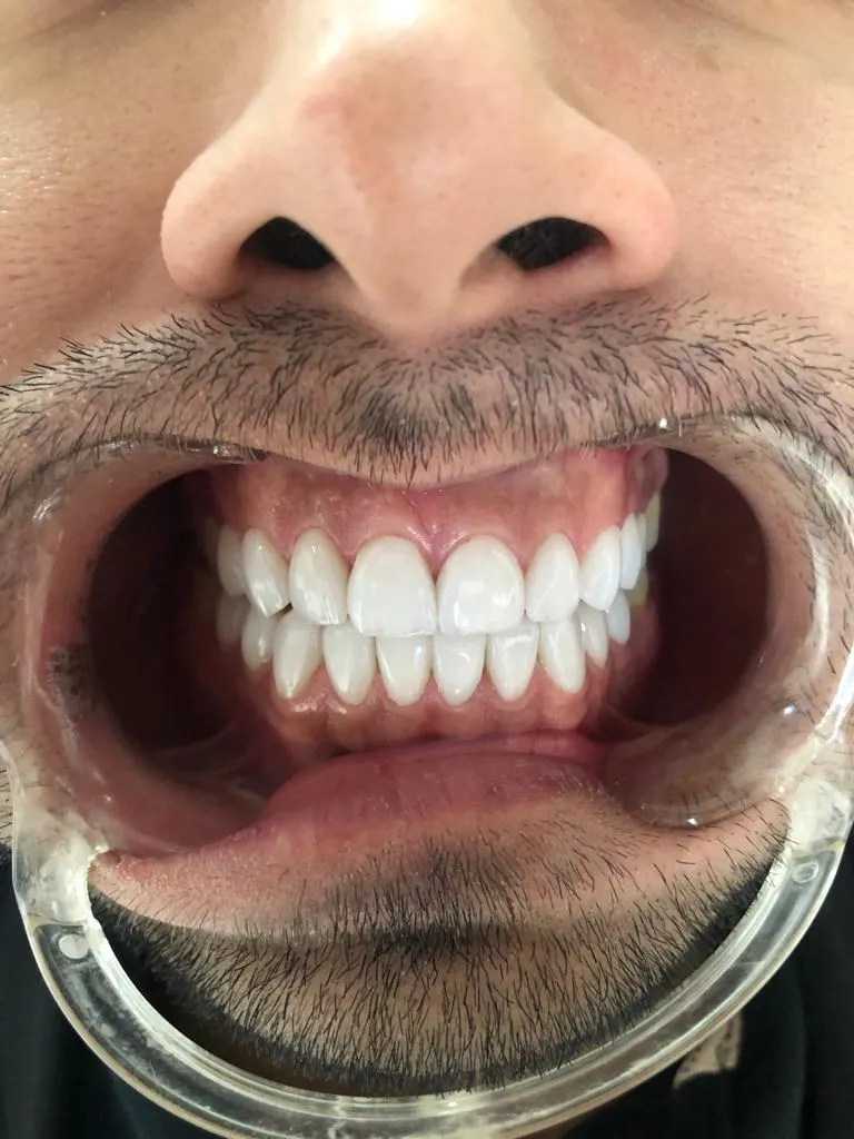 dental treatment 2
